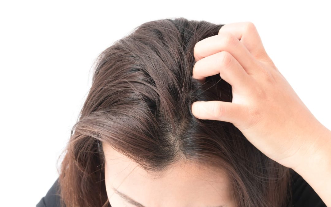 Does Picking at Your Scalp Cause Hair Loss