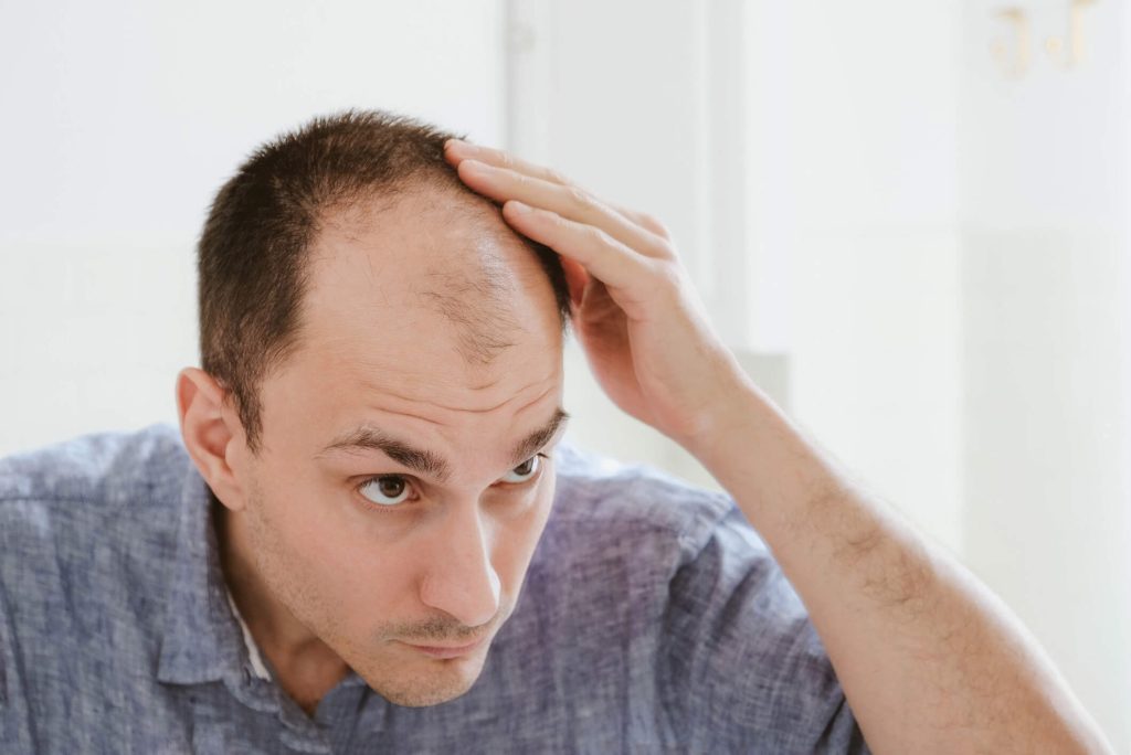 Can You Wear a Hat After a Hair Transplant