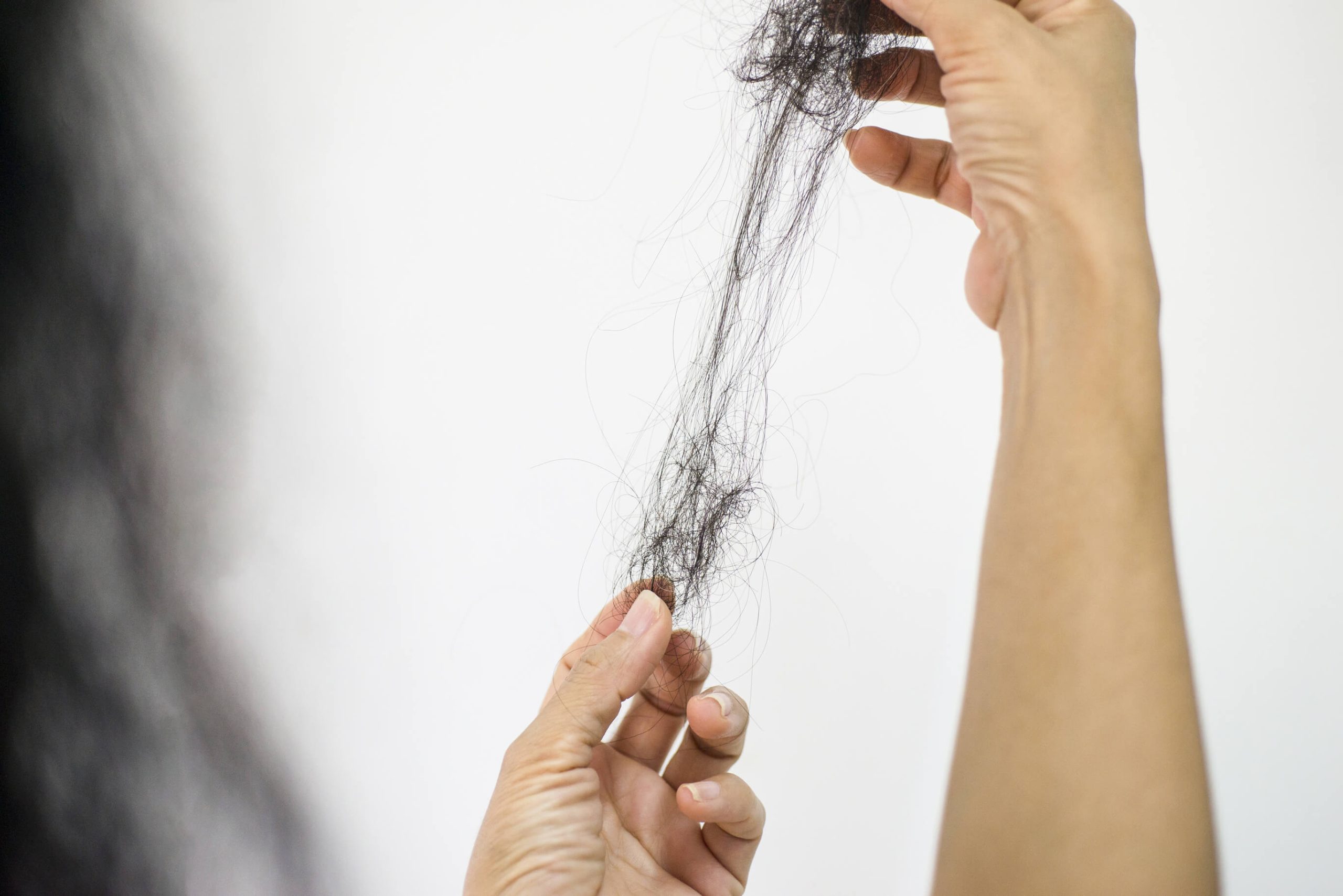 How Much Hair Is Normal to Lose in the Shower