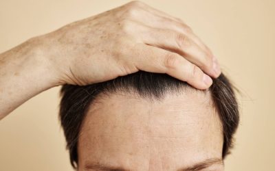 Mature Hairline vs Receding Hairline: What You Need to Know